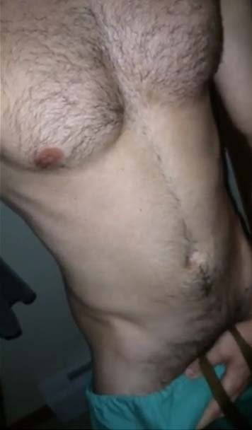 enfermeiro pica grande ao natural pau peludo amador gay